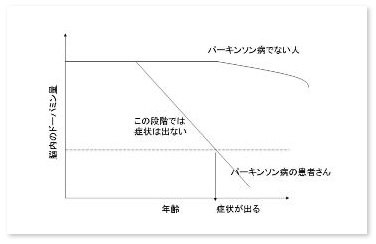 パーキンソン病の治療